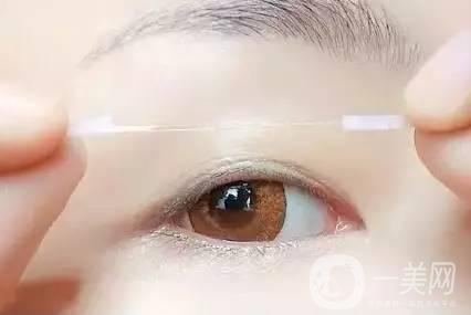 還在離不開雙眼皮貼嗎？雙眼皮手術(shù)助你雙眸
