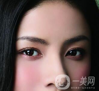 還在離不開雙眼皮貼嗎？雙眼皮手術(shù)助你雙眸