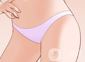 陰唇整形