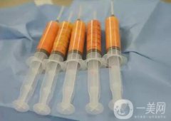 廣東做自體脂肪去法令紋的價(jià)格大概多少錢