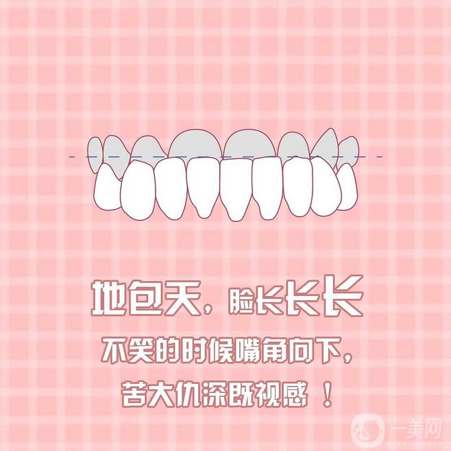 地包天矯正報(bào)價(jià)