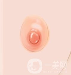 乳暈縮小整形手術(shù)價格是多少呢?