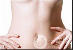 去妊娠紋價(jià)格如何 ？貴不貴？