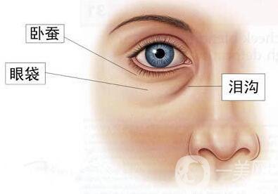 *去眼袋,*去眼袋價格