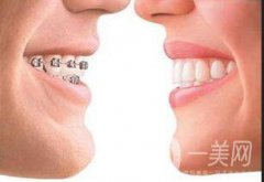 上顎整形報(bào)價(jià)是多少？