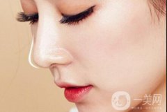 隆鼻價格高嗎？價格是多少？