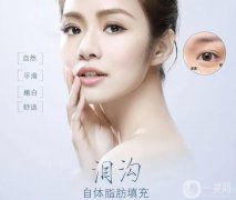 自體脂肪填充淚溝貴嗎？
