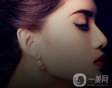 隆鼻都有哪幾種？