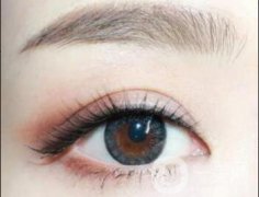 雙眼皮貴不貴呢?價(jià)格是多少？