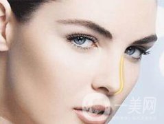 假體隆鼻大概需要多少錢？
