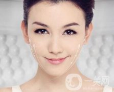 駝峰鼻矯正多久能恢復(fù)呢?