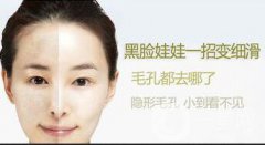 黑臉娃娃的功與作用介紹，關(guān)于皮膚管理的干貨也有哦