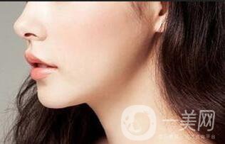 光子嫩膚,光子嫩膚調(diào)節(jié)黃褐斑,光子嫩膚調(diào)節(jié)黃褐斑優(yōu)缺點(diǎn)