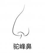 駝峰鼻矯正整形價(jià)格是多少？