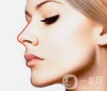 耳軟骨隆鼻的價(jià)格 耳軟骨隆鼻多少錢