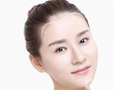 改發(fā)際線價(jià)格是多少？