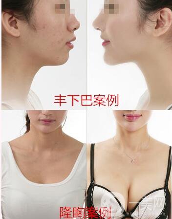 重慶藝星整形美容醫(yī)院