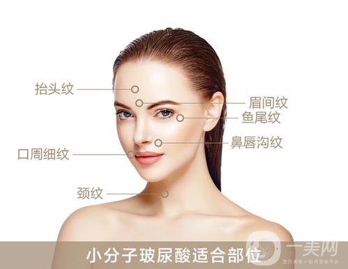 上海瑞蘭玻尿酸價格？*果怎么樣？
