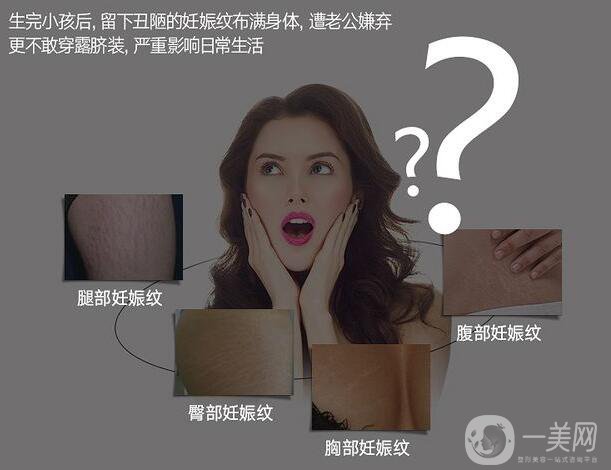 去妊娠紋價(jià)錢(qián)是多少？