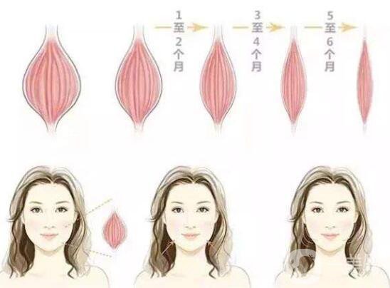 *能維持多長時間 注射*注意事項(xiàng)