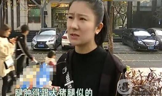 驚！女子花5萬整形，大腿留下17厘米疤痕