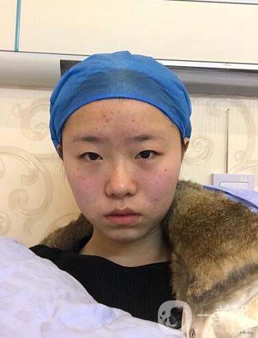 整容到底為了什么？知乎回答扎進(jìn)心窩