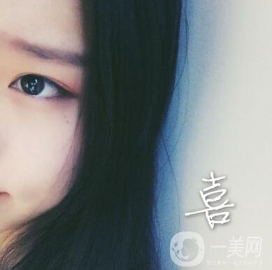 整容到底為了什么？知乎回答扎進(jìn)心窩