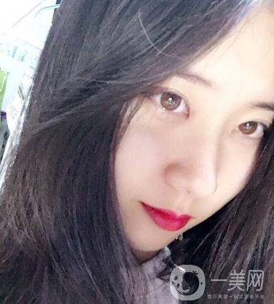 整容到底為了什么？知乎回答扎進(jìn)心窩