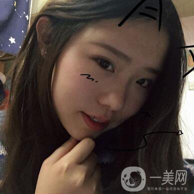 整容到底為了什么？知乎回答扎進(jìn)心窩