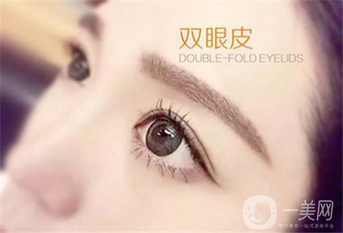什么叫埋線雙眼皮 埋線雙眼皮怎么樣？