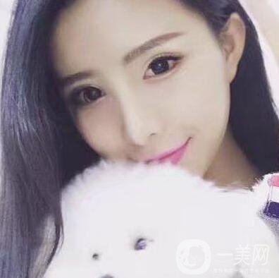 什么是芭比眼平行雙眼皮？