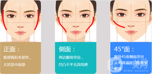 磨顴骨前后圖 磨顴骨多少錢(qián)