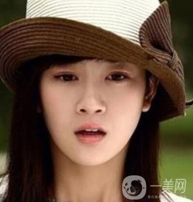 明星整容就是不承認(rèn)？ 然后突然臉“爛”了！