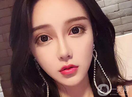 注射隆鼻好嗎 有哪些缺點呢？