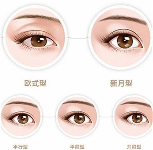 冬季割雙眼皮注意什么？術后吃什么好？