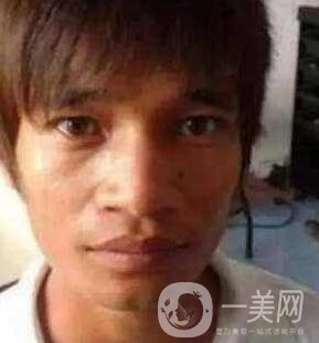 小伙整容數(shù)十次，只為一張韓星臉