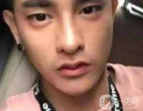 小伙整容數(shù)十次，只為一張韓星臉