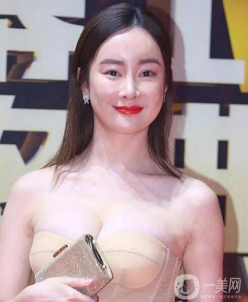 賈靜雯、迪麗熱巴的雙眼皮是不是割的 看了這個你就明白了