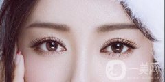 高分子割雙眼皮可以維持多長(zhǎng)時(shí)間呢?注意事項(xiàng)有哪些？