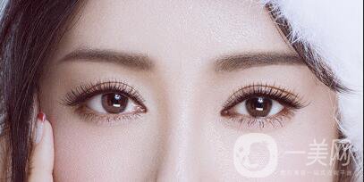 高分子割雙眼皮維持多長時間,高分子割雙眼皮注意事項