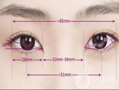 什么人適合開(kāi)眼角 開(kāi)眼角需要注意什么