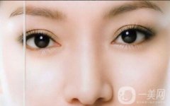 雙眼皮怎么樣？果如何呢？