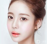 韓式開眼角手術(shù)果怎么樣？