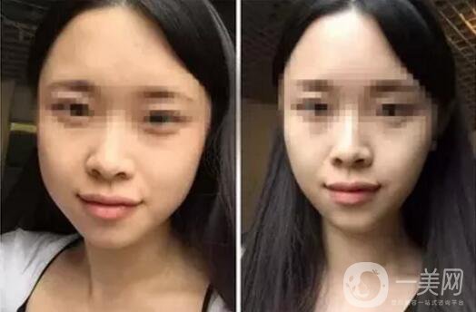 **果好嗎？*前后圖