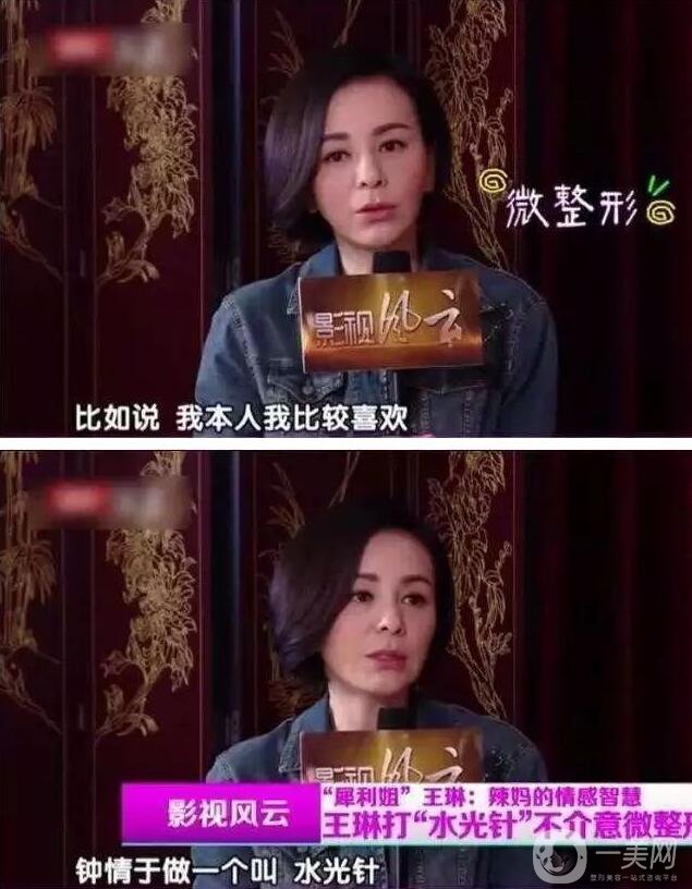 為什么眾多明星都鐘愛(ài)*？
