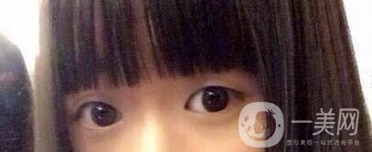整容整得好看是怎樣一種體驗？眾知乎美女回答讓你羨慕嫉妒恨！