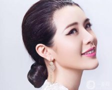 面部脂肪填充通常費(fèi)用高嗎 果好不好
