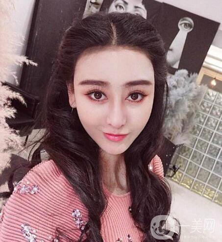又一個整容失敗的女明星，鼻子都整歪了，不甘心揚言還要植發(fā)！