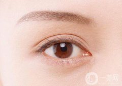 雙眼皮手術(shù)恢復(fù)時(shí)間-雙眼皮術(shù)后注意事項(xiàng)