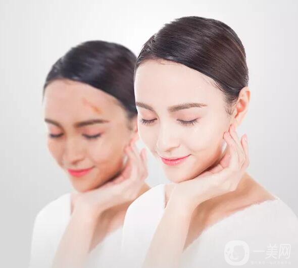 增生疤痕注意事項有哪些？該如何預(yù)防及調(diào)節(jié)？